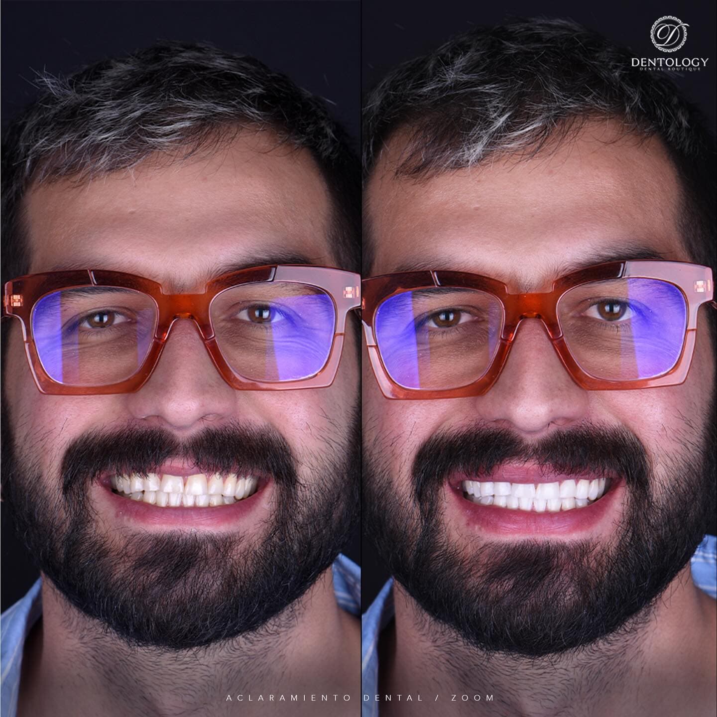 Dentology - Dentista en Polanco, Ciudad de México