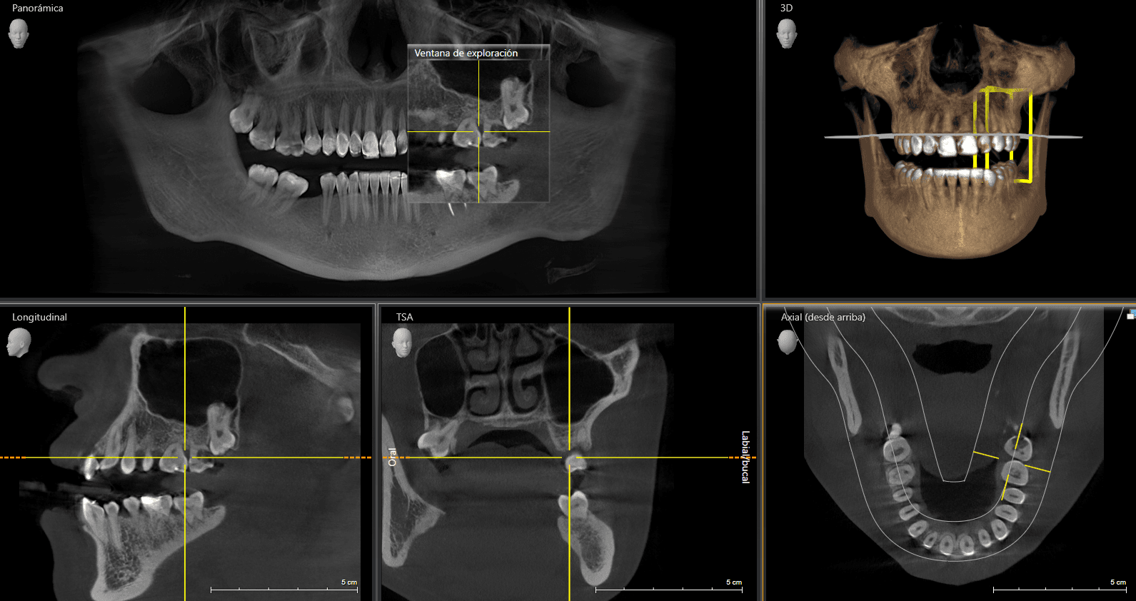Tratamiento del Trastorno de la ATM - Dentology Dental Boutique