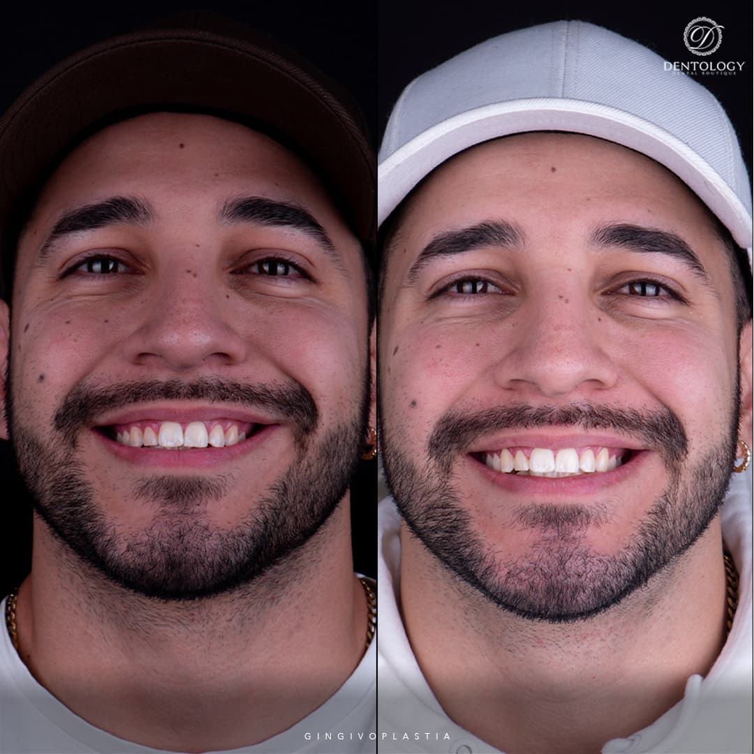 Dentology - Dentista en Polanco, Ciudad de México