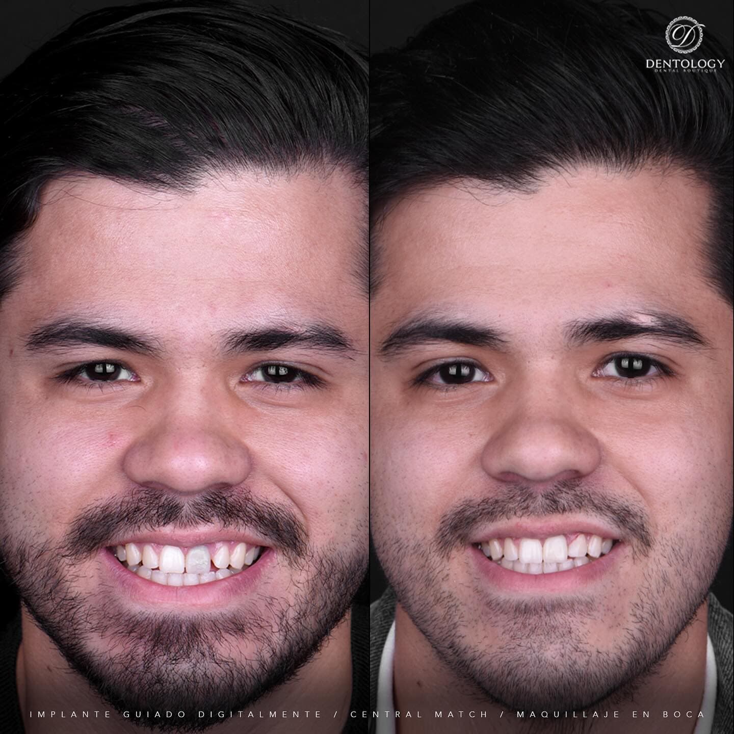 Dentology - Dentista en Polanco, Ciudad de México