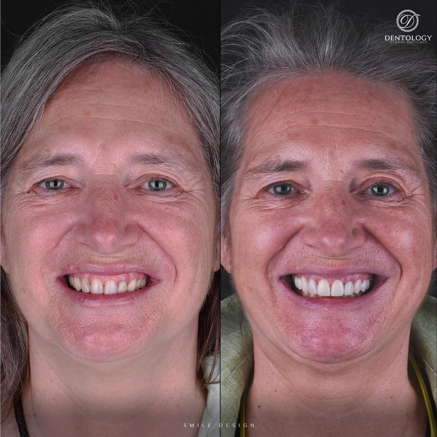 Dentology - Dentista en Polanco, Ciudad de México