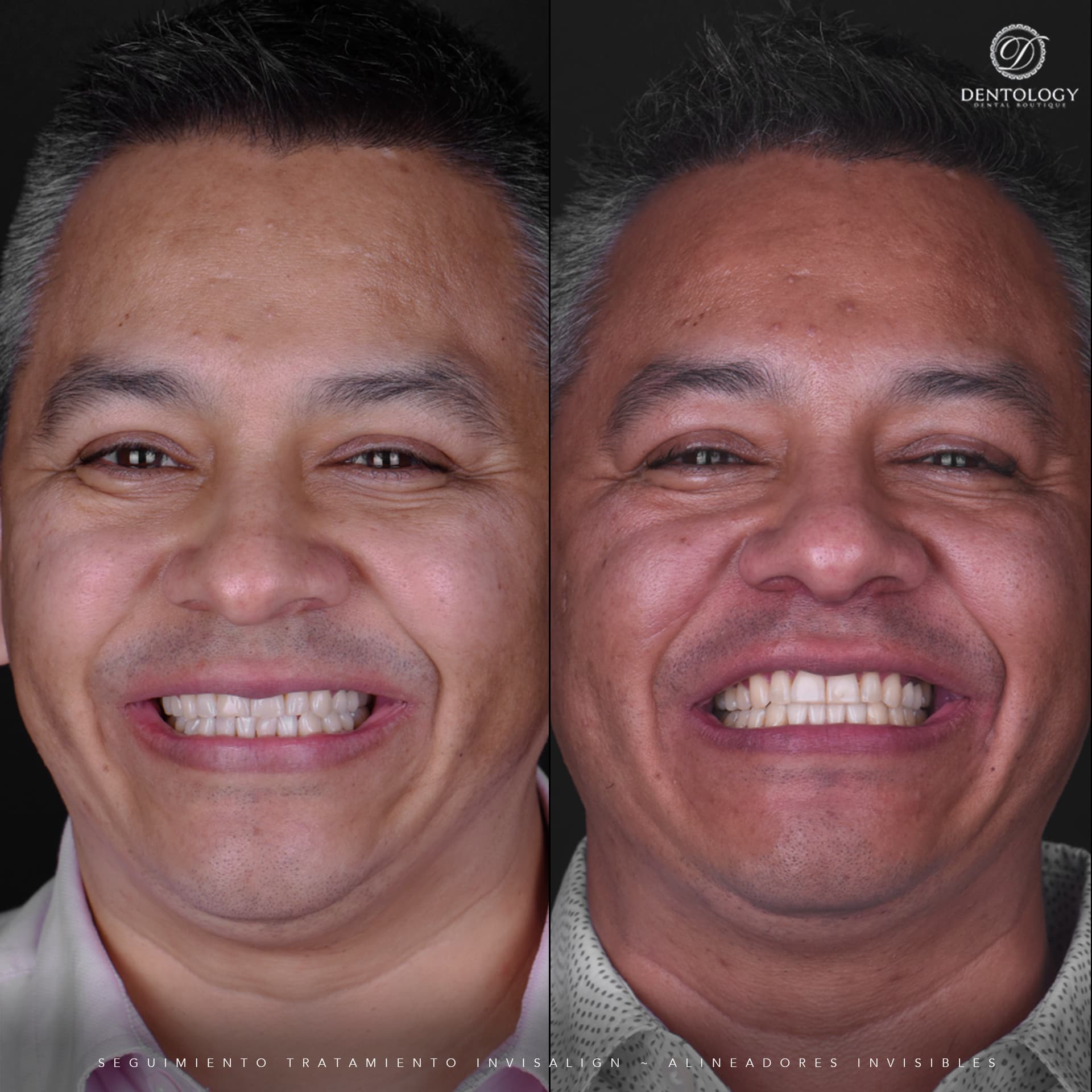 Dentology - Dentista en Polanco, Ciudad de México