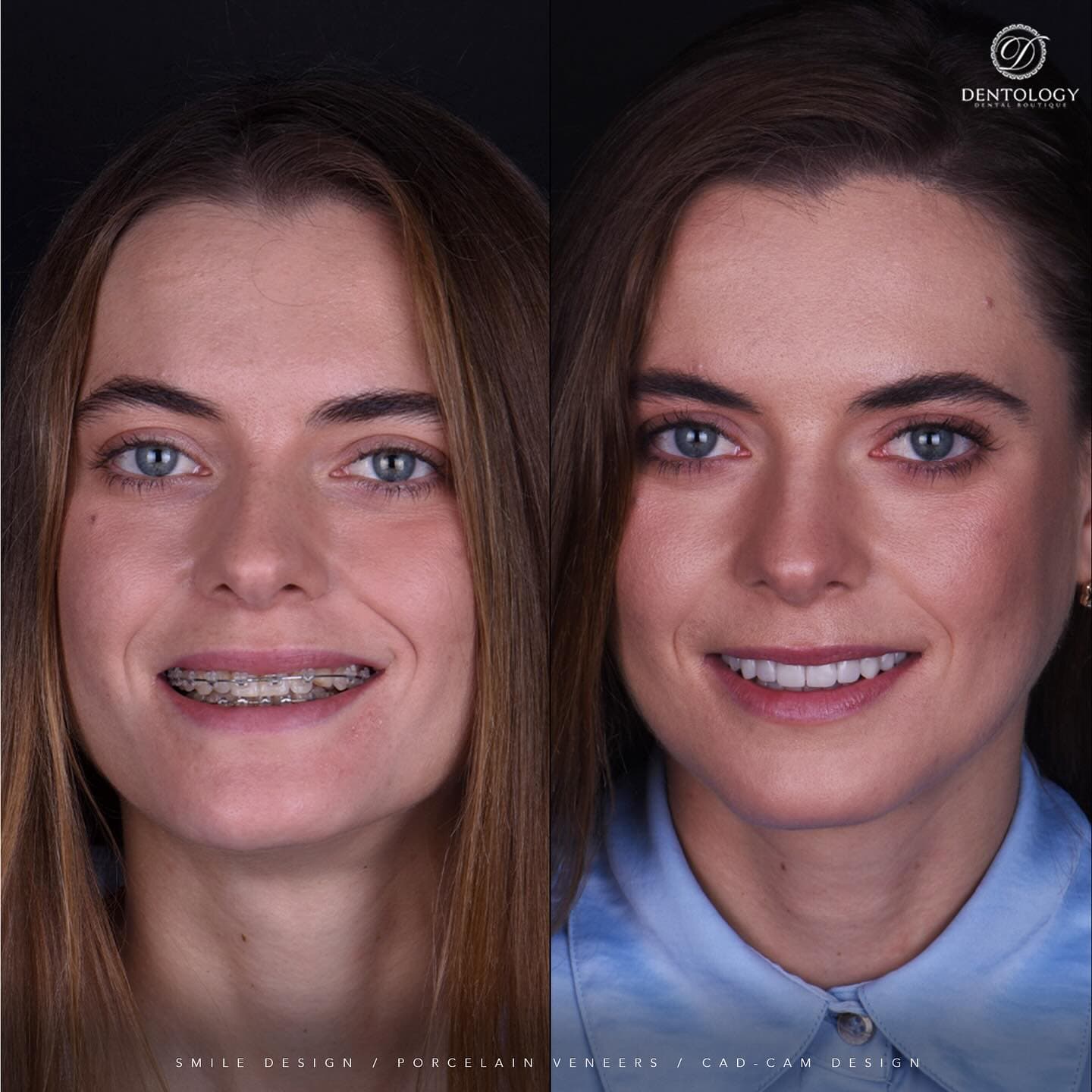 Dentology - Dentista en Polanco, Ciudad de México