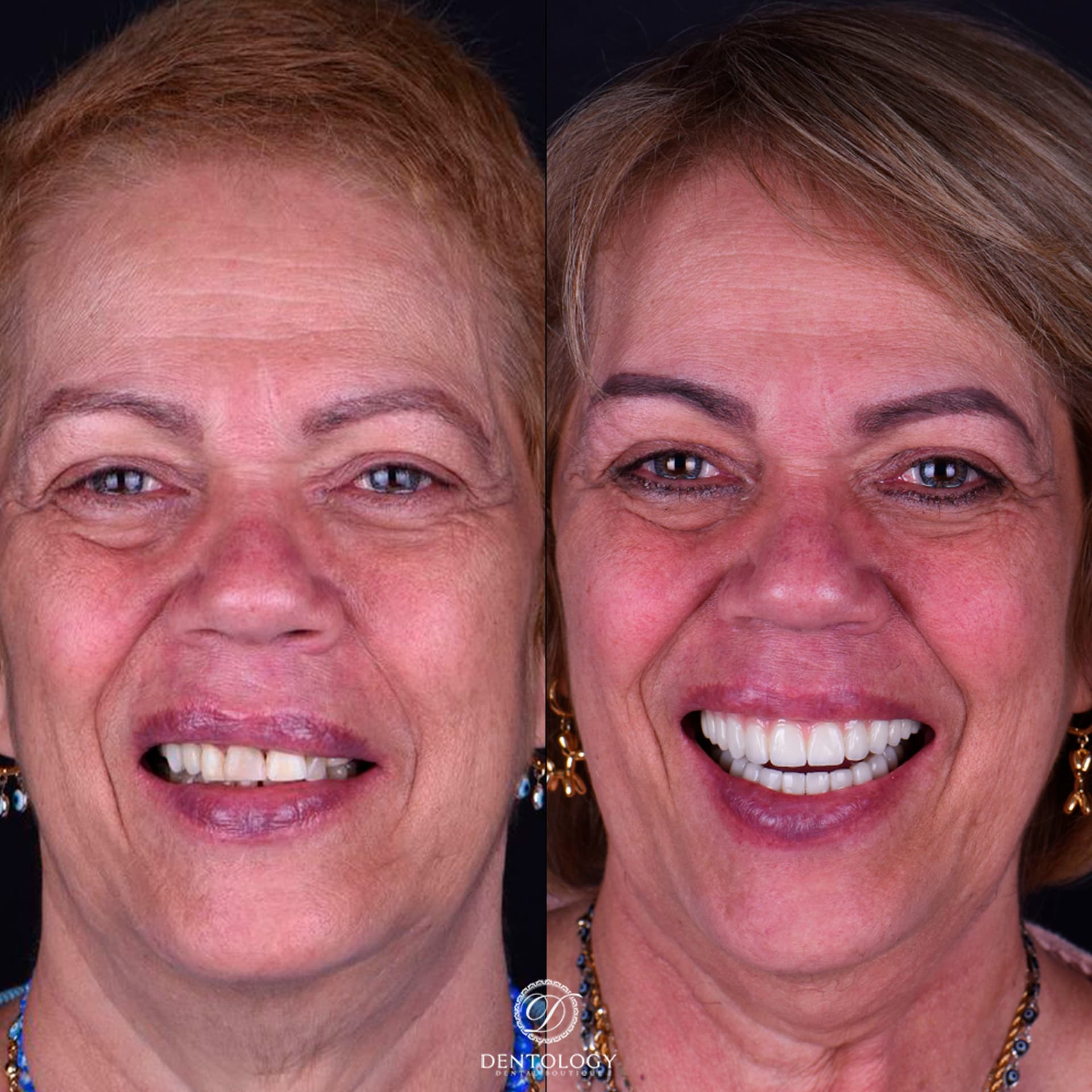 Dentology - Dentista en Polanco, Ciudad de México