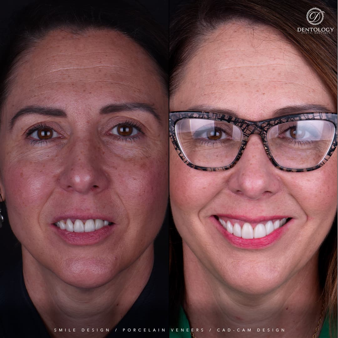 Dentology - Dentista en Polanco, Ciudad de México