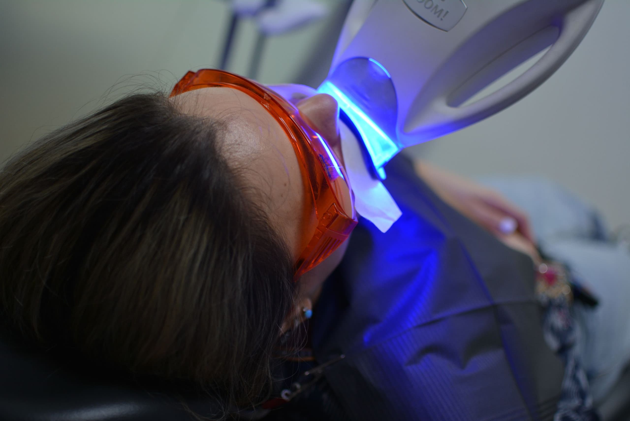 Blanqueamiento Dental - Dentology Dental Boutique