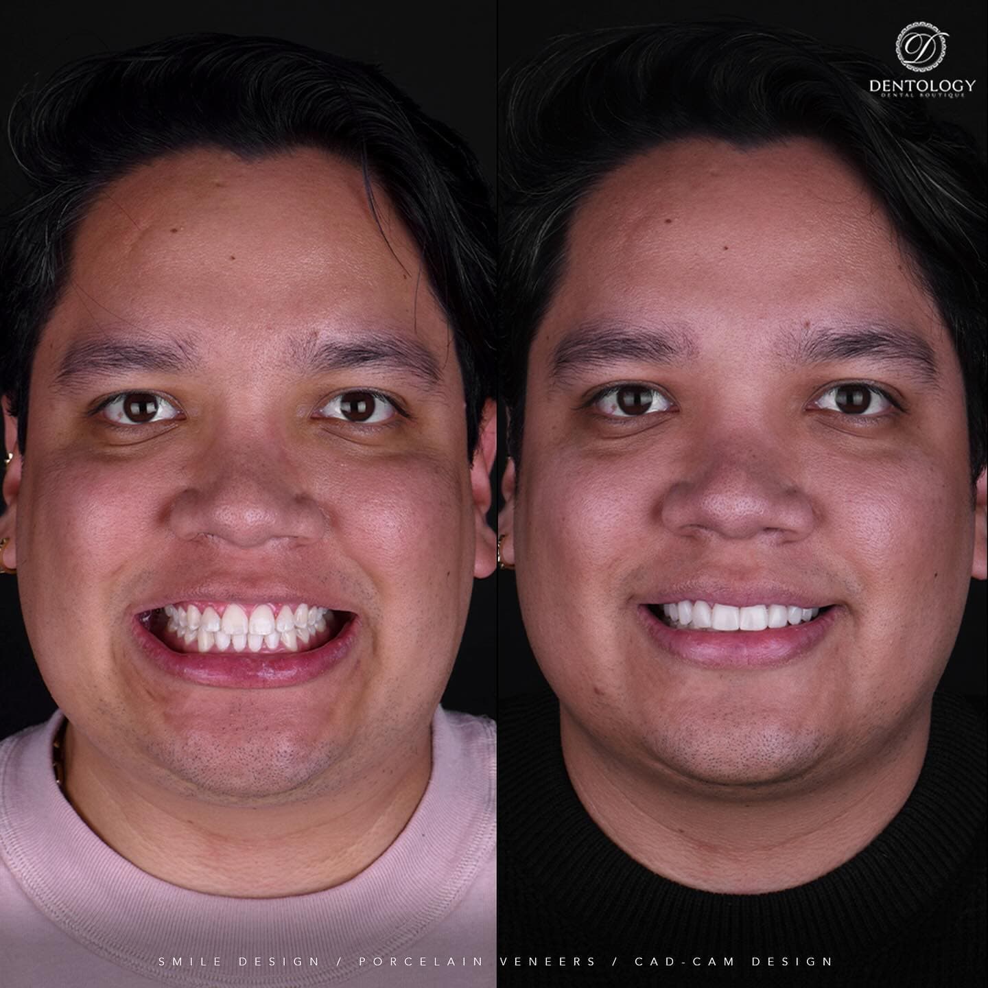 Dentology - Dentista en Polanco, Ciudad de México