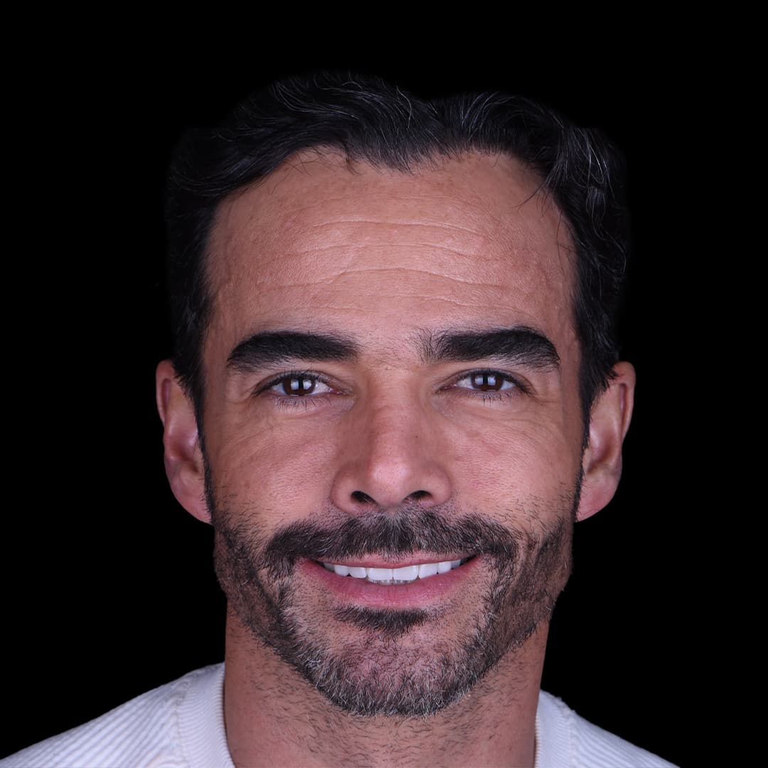 Dentista Cosmético en Ciudad de México - Dentology Dental Boutique