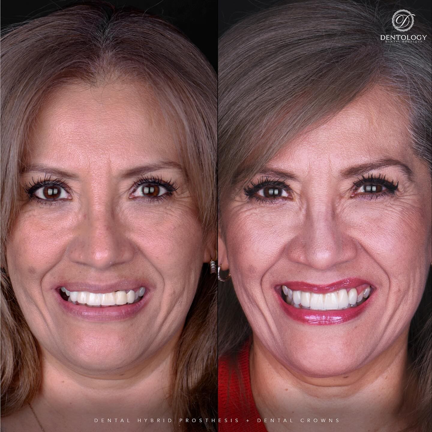 Dentology - Dentista en Polanco, Ciudad de México