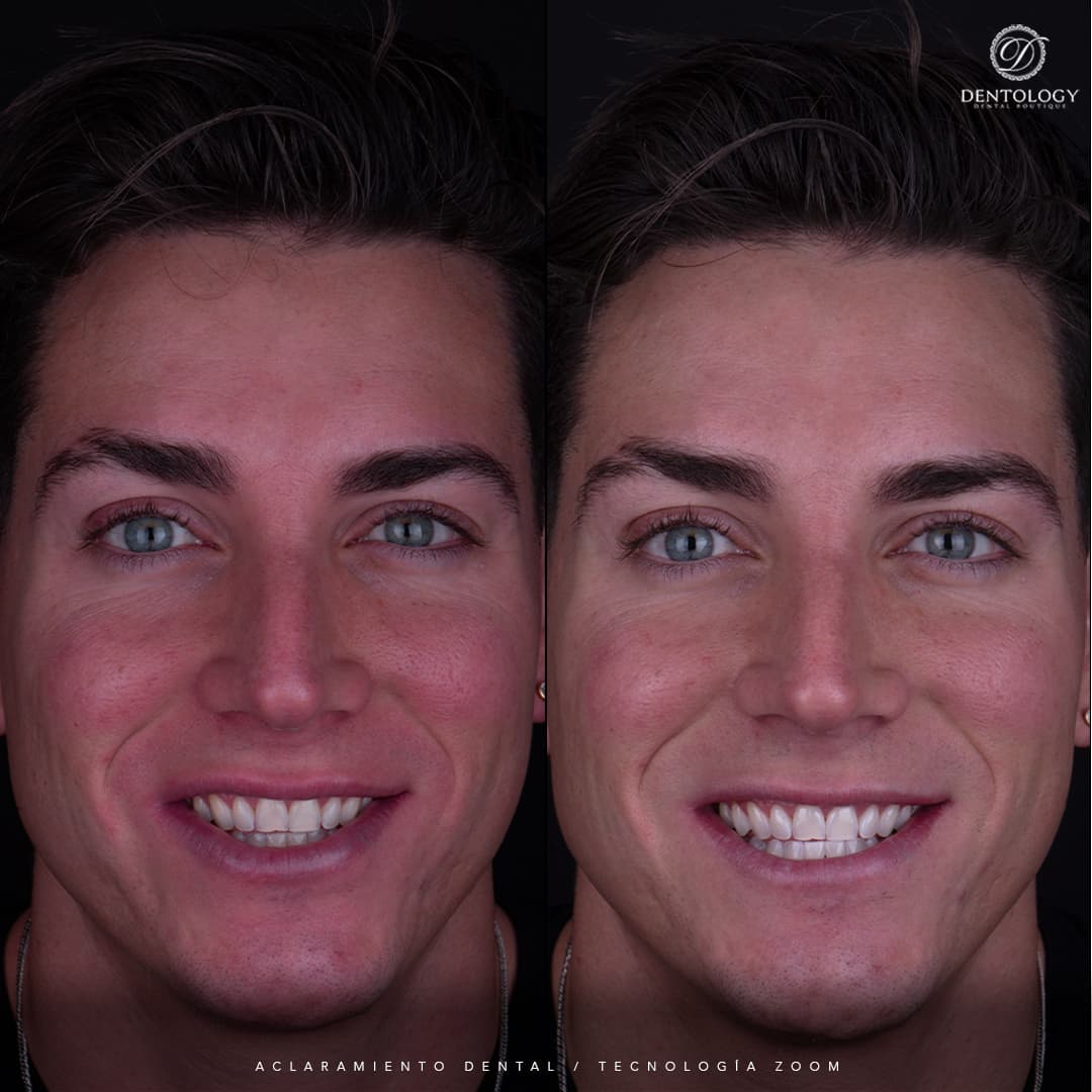 Dentology - Dentista en Polanco, Ciudad de México